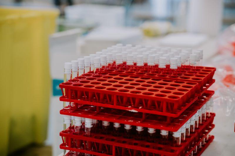 Test tubes for blood samples in a lab